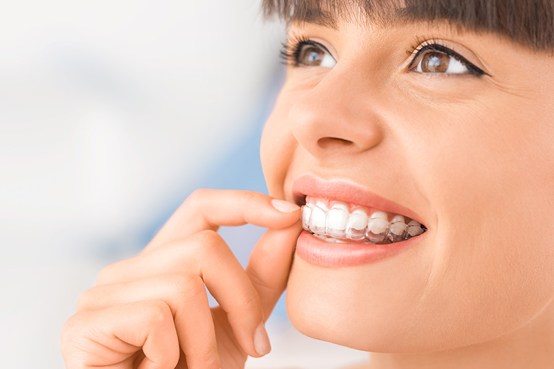 Clear Correct Clear Aligners  in Philadelphia